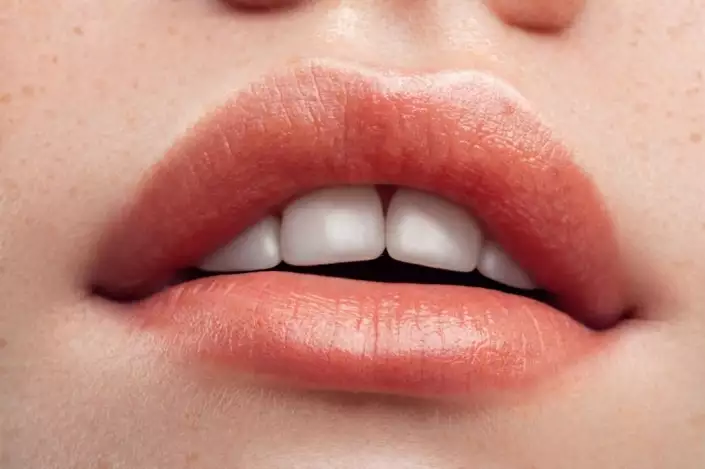 Naturale Filler Labbra | Sintomi, Costi, Prima e Dopo